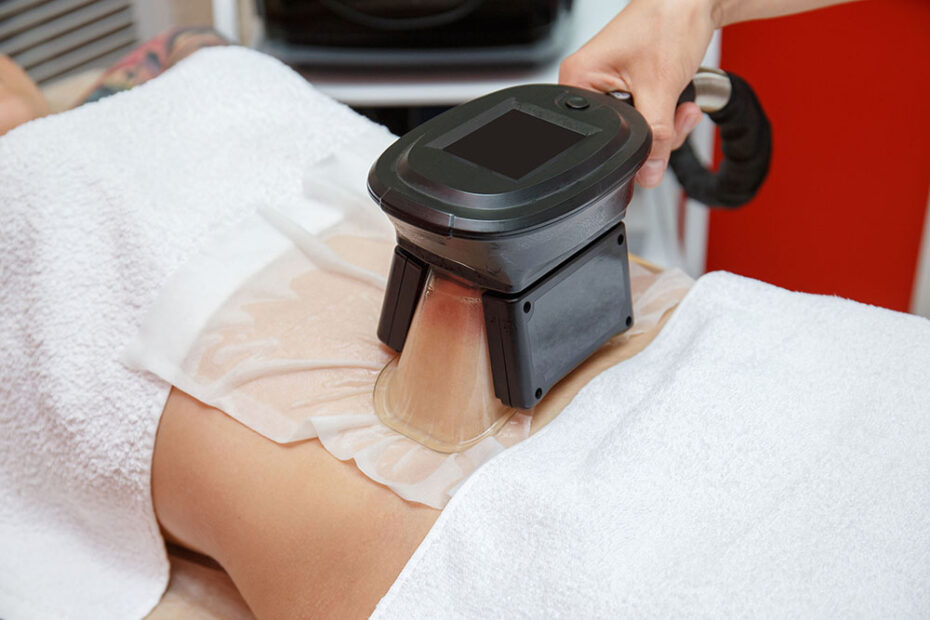 Institut-de-minceur-lyon-Cryolipolyse-Avant-Après-Un-Traitement-Contre-La-Cellulite-Efficace-C2