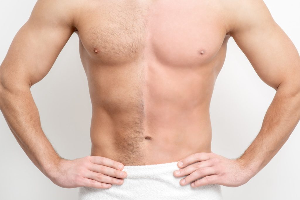 Institut-de-minceur-lyon-Epilation-definitive-pour-homme-choisir-sa-methode