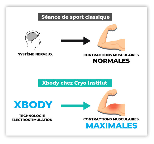 Avantage-xbody-par-rapport-salle-de-sport-cryoinstitut-lyon